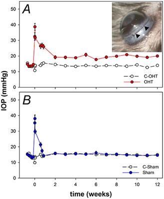 Characterization of the Circumlimbal Suture Model of Chronic IOP Elevation in Mice and Assessment of Changes in Gene Expression of Stretch Sensitive Channels